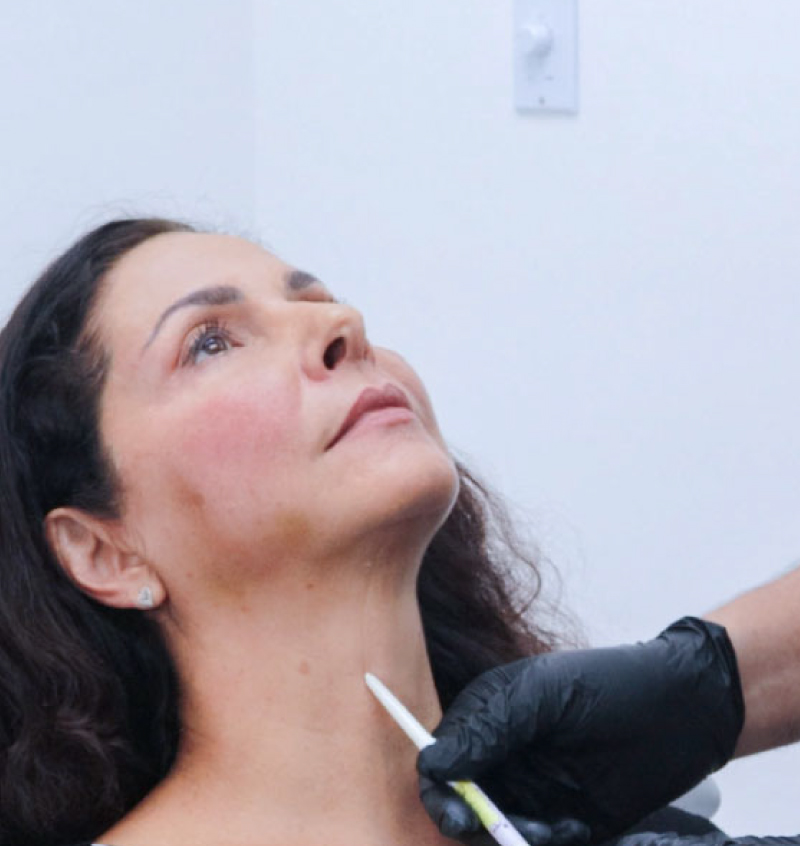 Fillers en Cancún